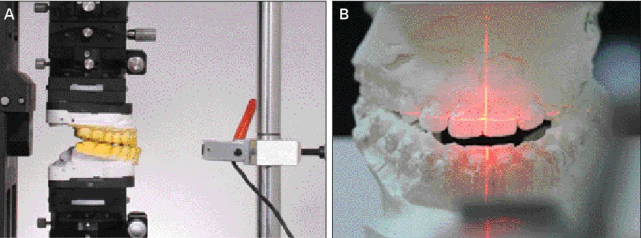 Fig. 5. A. Lateral view of mounted casts and laser beam; B. Laser beam on the cast. Vertical line is the mid-sagittal, horizontal line is equal to upper lip line.