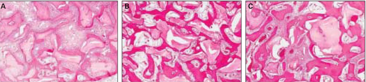 Fig. 1. A. Bio-Oss � + PRP, 4 weeks. B. Bio-Oss � + PRP, 8 weeks. C. Bio-Oss � + PRP, 12 weeks.
