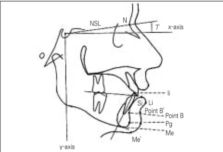 Fig. 1. Reference  lines  and  points  in  cephalometric  mea- mea-surements. (NSL: nasion-sella line)