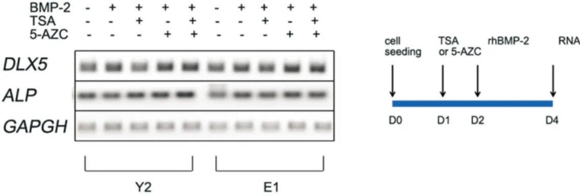Fig. 5. Osteogenic marker gene expression of hBMSC after TSA, 5-AZC pretreatment by semiquantitive RT-PCR.