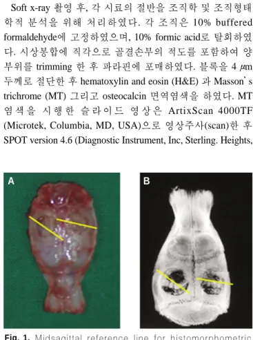 Fig. 1. Midsagittal  reference  line  for  histomorphometric analysis. A. Harvested calvaria, B