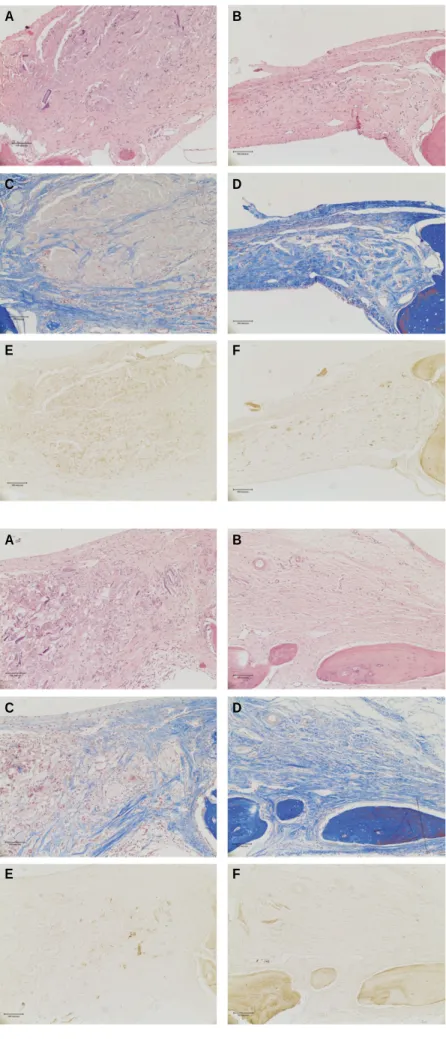 Fig. 7. A.  Postoperative  4  weeks.(H&amp;E  staining, original  magnification  x100)  B