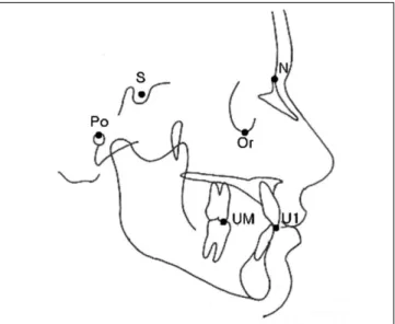 Fig. 1. Anatomic landmark used in this study. 