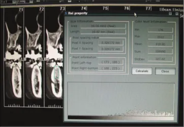 Fig. 1. Image  of  transaxial  cut  of  Somatom  computed tomography (CT). 