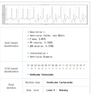 그림 7. 레코드 223번에 대한 제안된 알고리즘의 분류 과정 Fig. 7. Classification procedure of proposed algorithm for