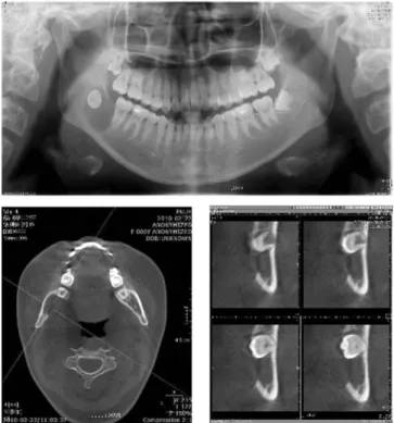 Fig. 1. Preoperative X-ray.