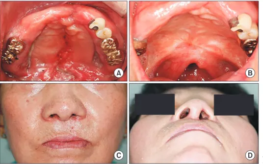 Fig. 3. Postoperative clinical features. 