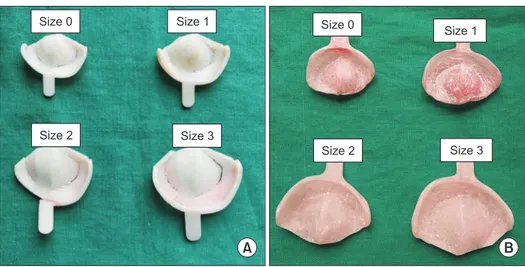 Table 2. Weight of left-side cleft lip and palate impression trays  Sr. No.  Size of the tray Weight of the tray (mg) 