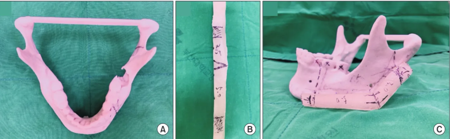 Fig. 8. Rapid prototype (RP) model. A. RP model of mandible. B. Fibular resin model. C