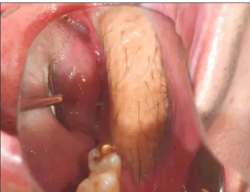 Fig. 11. The patient’s intraoral view after 2 months postopera- postopera-tively.
