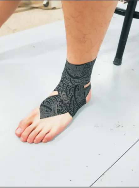 Figure 1. Kinesio ankle taping technique. Figure 2. Figure 2. Dynamic ankle taping technique.