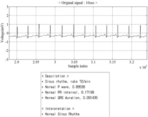 그림 4. 규칙기반 리듬 분류를 위한 사용자 인터페이스 Fig. 4. User interface for rule-based rhythm classification