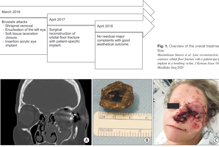 Fig. 1. Overview of the overall treatment  flow.