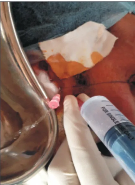 Fig. 1. Landmarks for arthrocentesis.