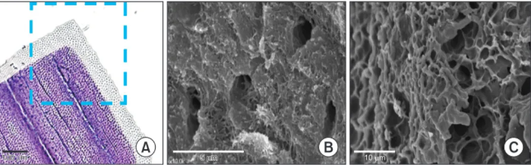 Fig. 1. Surface of demineralized dentin matrix (DDM) powder 26 . A. The surface of the DDM is stained gray due to the dentinal tubules,  while the mineralized core is stained violet (H&amp;E)