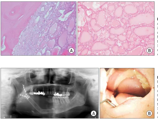 Fig. 5. Current state of the patient. A. 