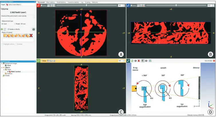 Fig. 4. A-C. Micro-computed tomography (CT) assessment of trephined bone using PhoenixV/tome/Xs machine image analyzing software