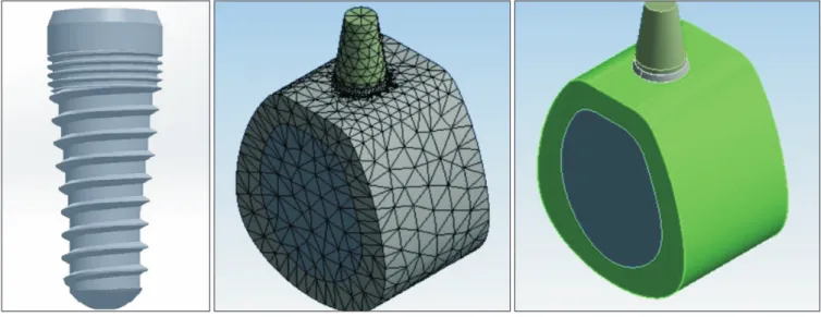 Fig. 1. Implant model and the whole model.