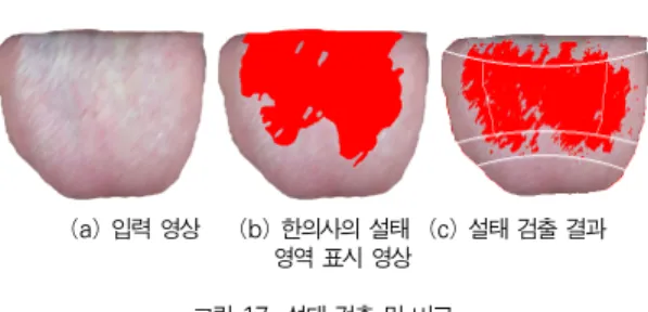 그림 16에는 영역 분할 후 설태 검출을 수행한 결과 예가 나타나 있다. 그림 16과 같이 각 영역 별로 설태를 검출한 다 음에는, 영역 별로 설태의 비율을 계산하여 그 비율에 따라 해당 기관의 건강 상태를 출력한다
