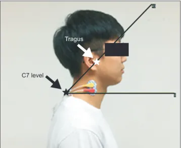 Figure 2. Craniovertebral angle.