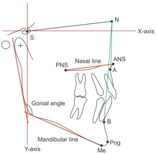 Fig. 1. Skeletal landmarks used in cephalometric analysis. Refer  to Table 1 for the definition of landmarks.