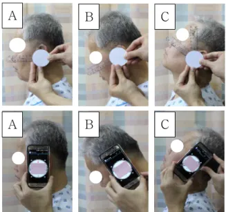 Figure  2.  Starting and measuring positions for goniometer and smartphone (A: neutral position, B: flexion, C: extension).