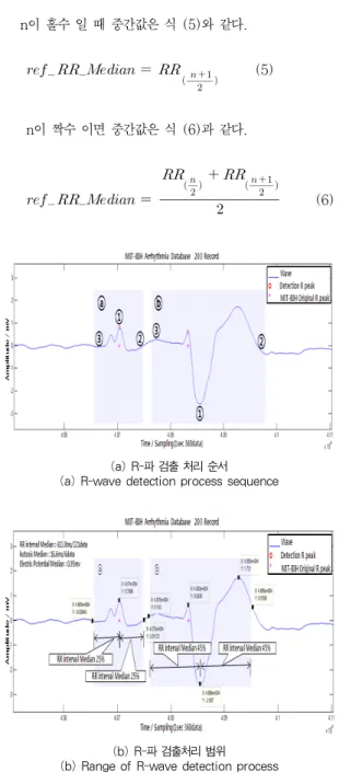 그림 7. R-파 검출 과정 Fig. 7. R-wave detection process