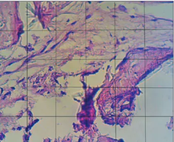 Fig. 2. Dentin/cementum particle (asterisk) and a blood vessel  (arrow) in an alveolar socket at the end of the second week