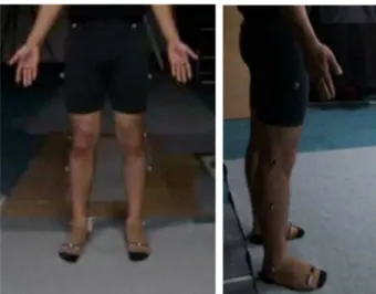 Figure  1.  Attachment areas of the body markers. 절 가동 범위 및 무릎 관절 내전 모멘트, 일률에 영향 을 미치며 무릎 관절 내전 모멘트와 관절 각도의 관계 가 있을 것이다