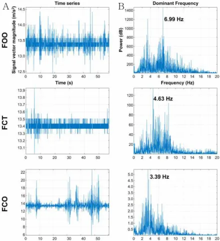 Figure  5.  A: Time series acceleration signal, B: frequency domain power spectral density from conditions of floor standing (FOO: floor with eye-opened and one-leg standing, FCT: floor with eye-closed and two-leg standing, FCO: floor with eye-closed and o