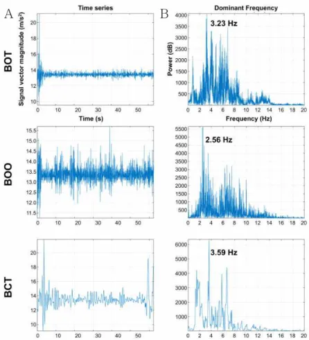 Figure  6.  A: Time series acceleration signal, B: frequency domain power spectral density from conditions of balance-board standing (BOT: balance-board with eye-opened and two-leg standing, BOO: balance-board with eye-opened and one-leg standing, BCT: bal
