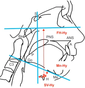 Fig. 4. Measurement of SV-Pog. The vertical distance from the  Sella vertical (SV) plane to the pogonion (Pog) was measured to  evaluate recurrence