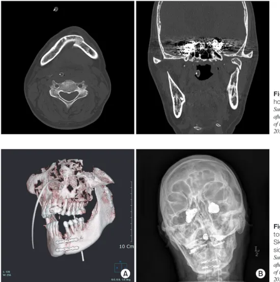 Fig.  6.  Computed  tomography  at  the  hospital upon initial examination.