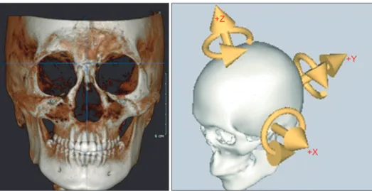 Fig. 1. Constructed coordinate system  used. X-axis (transverse axis) is a line  parallel to the frontozygomatic (FZ) line
