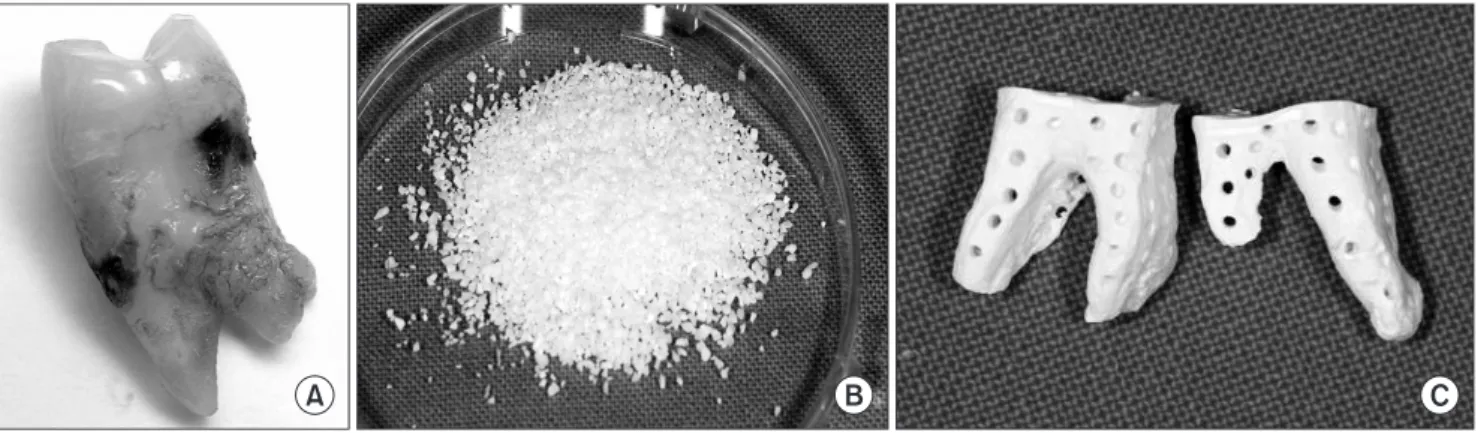 Fig. 1. A. Extracted teeth are ready to be fabricated into autogenous tooth bone graft (AutoBT) in either powder form or block form