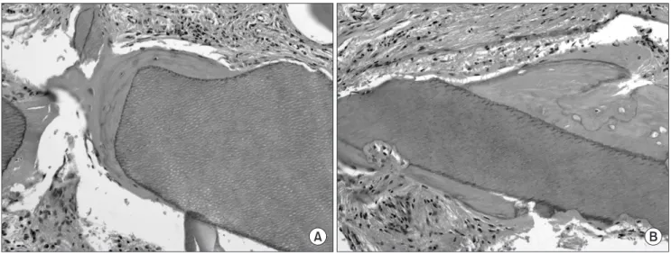 Fig. 4. A. High-magnification image of new bone formation around the tooth elements. Marginal scalloping of the implant chip suggested  that remodeling was occurring in the new bone-implant chip interface.(H&amp;E staining, ×100) B