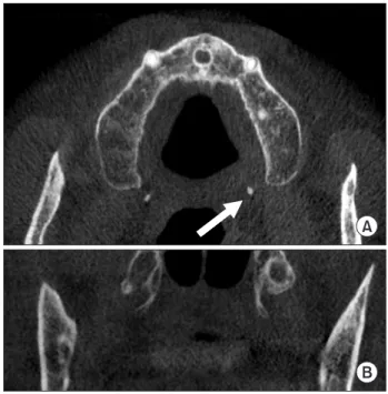 Fig. 2. Preoperative panoramic radiograph.