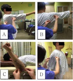 Figure  4.  Functional taping (1) Endura taping, (2) 1st taping, (3) 2nd taping, (4) 3rd taping.