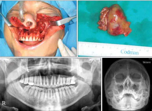 Fig. 2. Intraoperative view and posto­