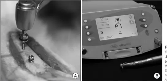 Fig. 1. Tested groups of orthodontic mini-implants. A. Control  group. B. Rotation bump group.