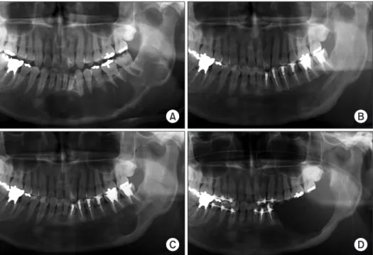Table  9.  The  correlation  between  radiografic  finding  and  re- re-currence
