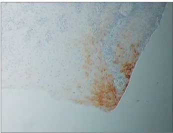 Table 5. Immunohistochemical expression of CK 17 
