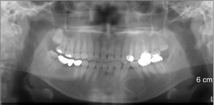 Fig. 3. Post-operative panoramic radiography.