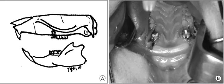 Fig. 1. Schematic design of the experiment (A) and titanium implants placed in the extraction socket of both maxillary first molars (B)