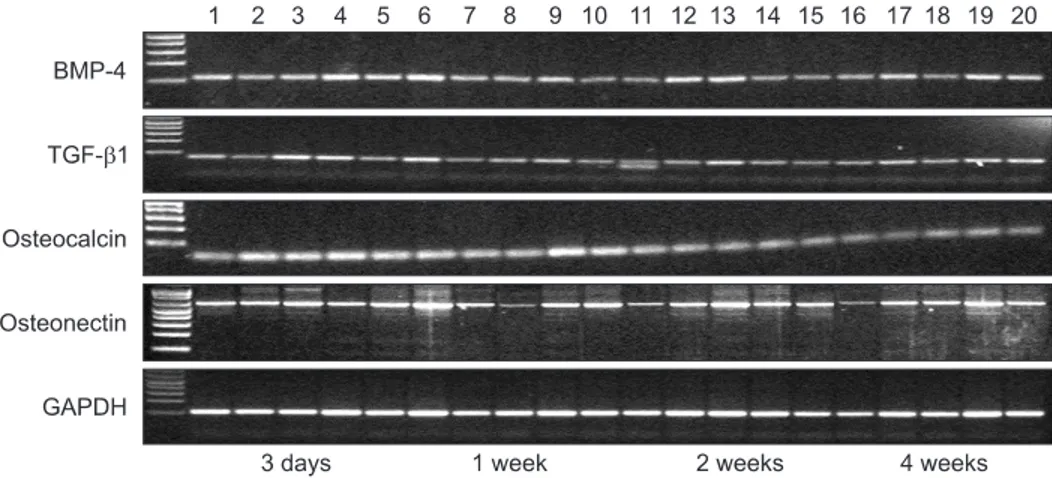 Fig. 2. Representative RT-PCR. RT-PCR products run on an agarose gel. The ratio of the fluorescence of each RT-PCR product to that of  GAPDH was calculated