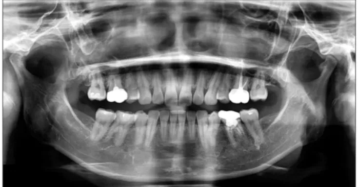Fig. 4. Post-operative panoramic view after 7 years.