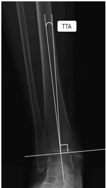 Figure  3.  Lower extremitiy isometric co-contraction (LEIC).
