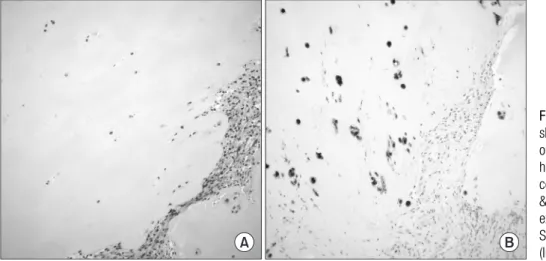 Figure 6. Pathologic features of extra- extra-skeletal chondroma. (A) The tumor consists  of the circumscribed lobules of mature  hyaline cartilage
