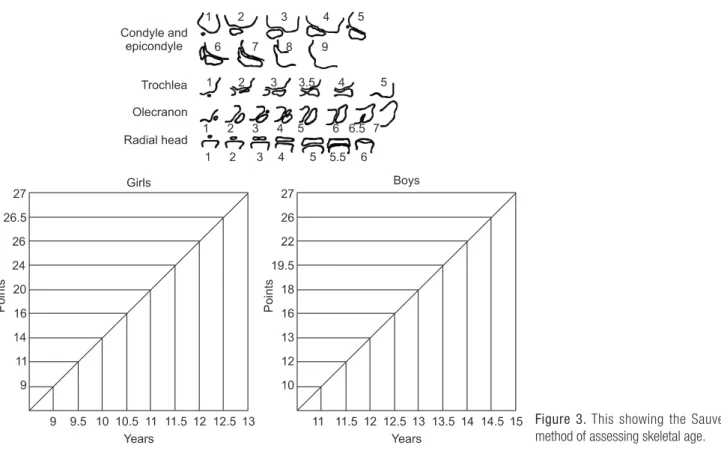 Figure 3. This showing the Sauvegrain  method of assessing skeletal age.