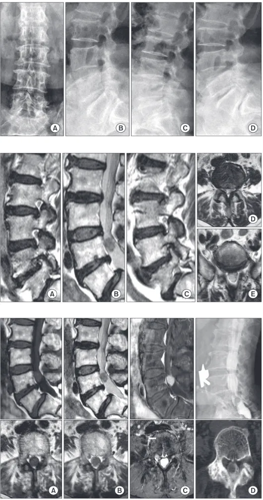 Figure 1. Preoperative plain radiographs. 